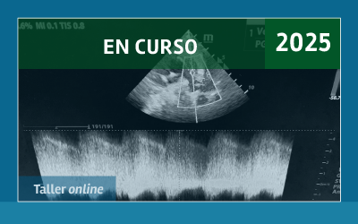 2da. EDICIÓN - Ecocardiograma funcional del Recién Nacido