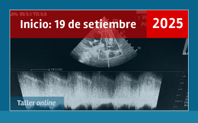 2da. EDICIÓN - Ecocardiograma funcional del Recién Nacido